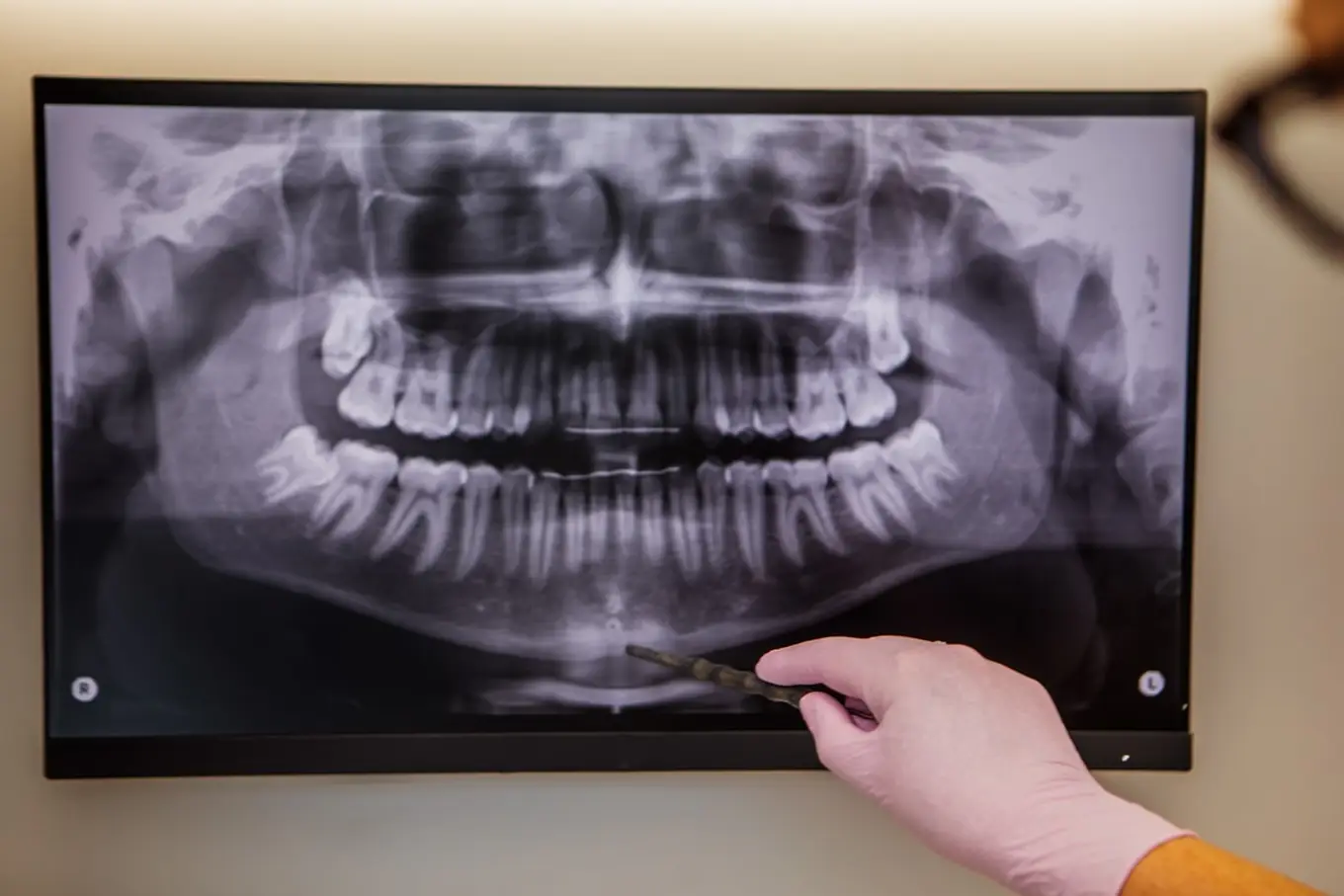 tomografia zębów warszawa best way dent