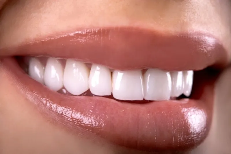 zdrowy uśmiech z implantami